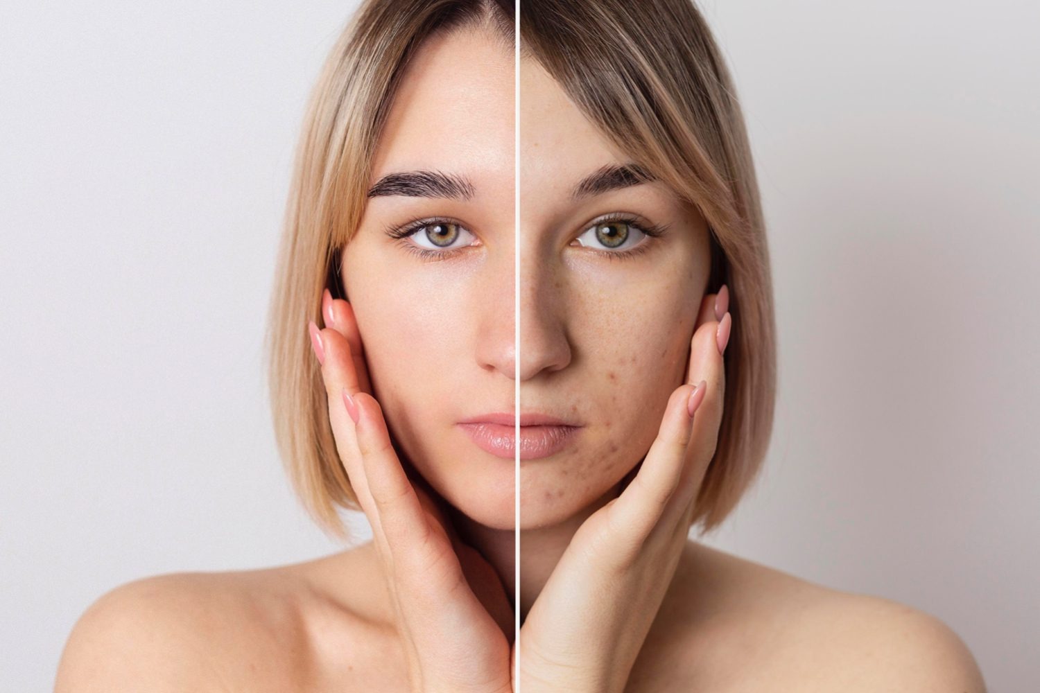 شناخت پوست و عوامل موثر بر آن
