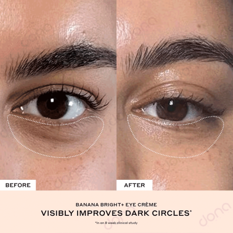 تست کرم دور چشم Banana Bright اوله هنریکسن